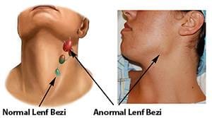LENF-BEZİ